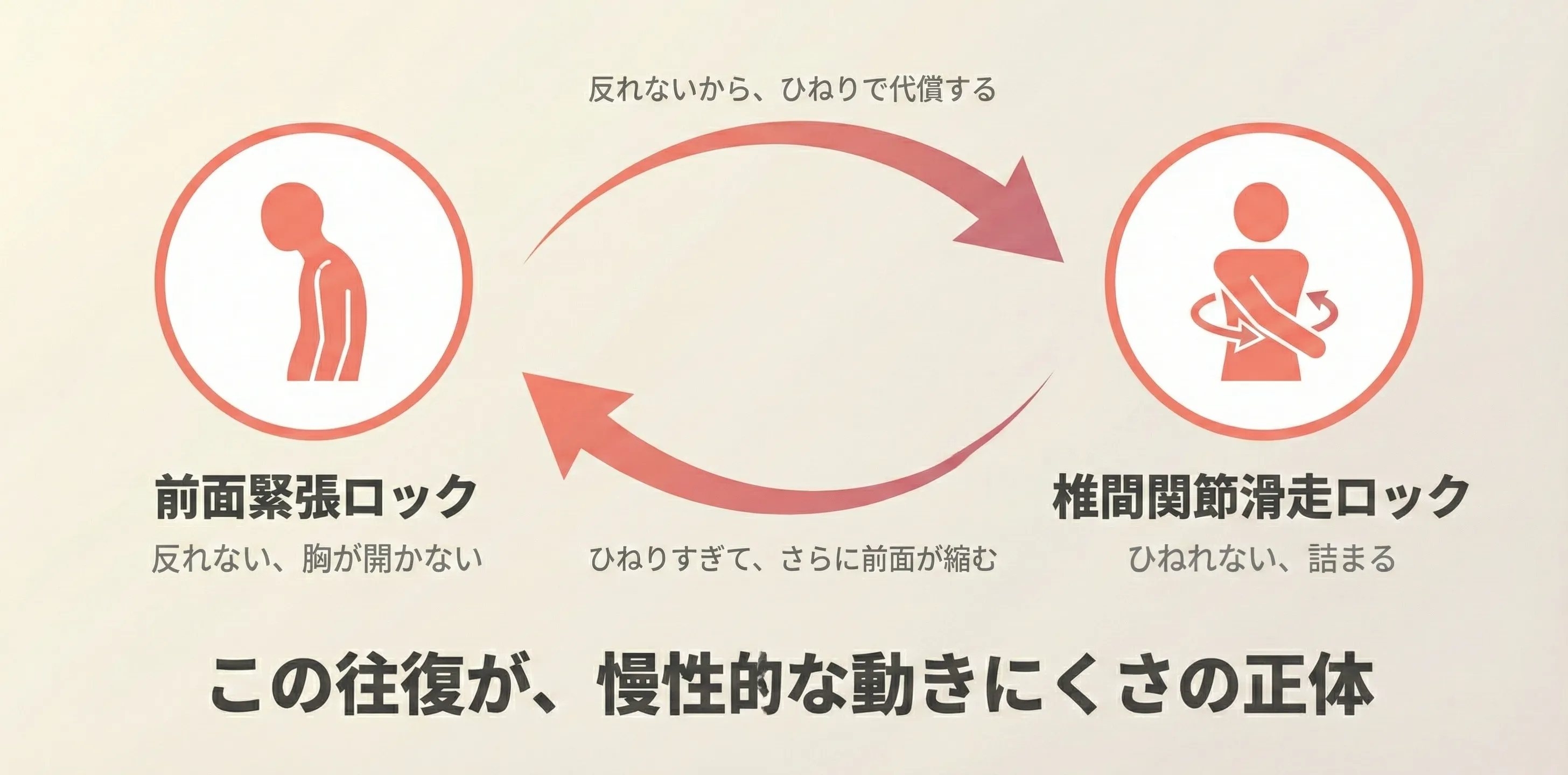 Front Tension Lock（前面緊張）とFacet Glide Lock（椎間関節滑走不全）が相互に増悪し合う悪循環サイクルの図解