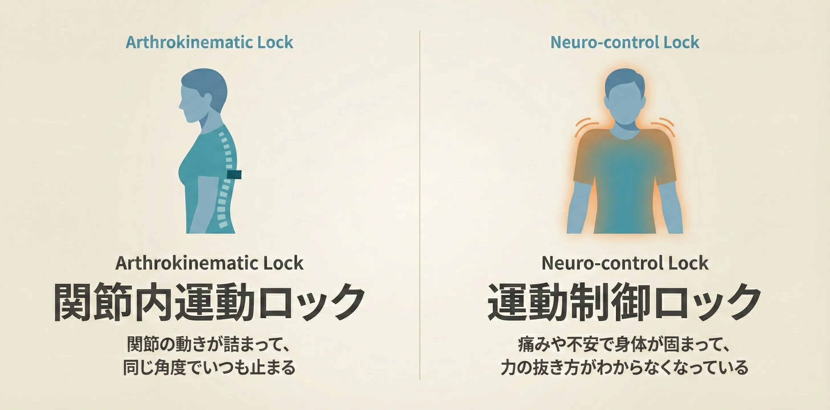 Arthrokinematic Lock（関節内運動ロック）とNeuro-control Lock（運動制御ロック）の2つの原因を示す概念図