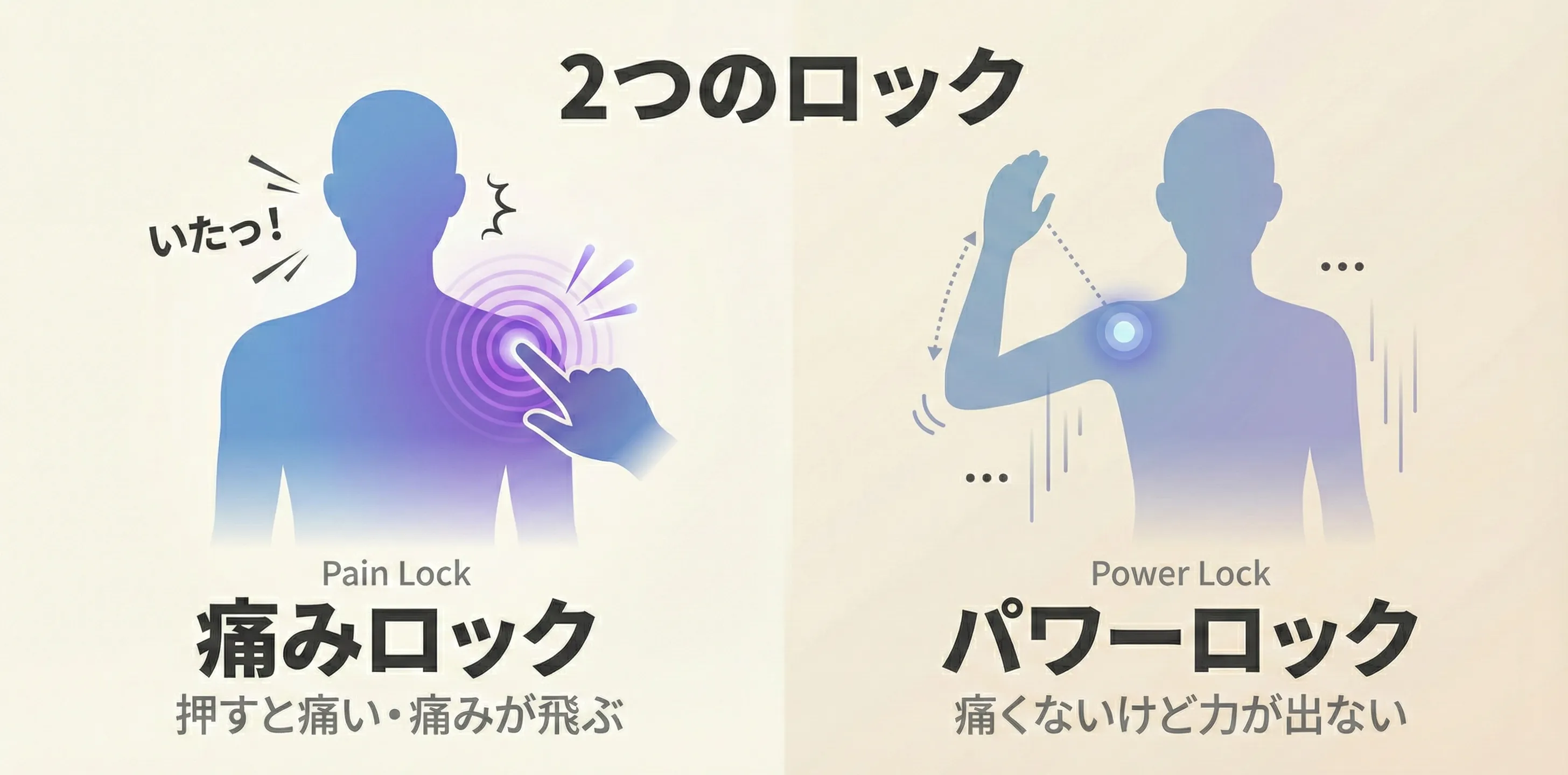 Pain Lock（痛みロック：痛みが前面に出るTP）とPower Lock（出力ロック：動きの邪魔になるTP）の2つの原因を示す概念図